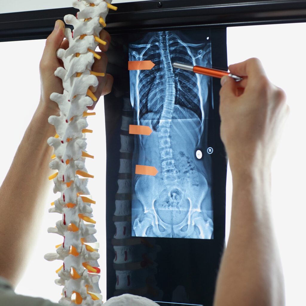 Professional with  model  of spine watching image of chest  at x-ray film viewer. 