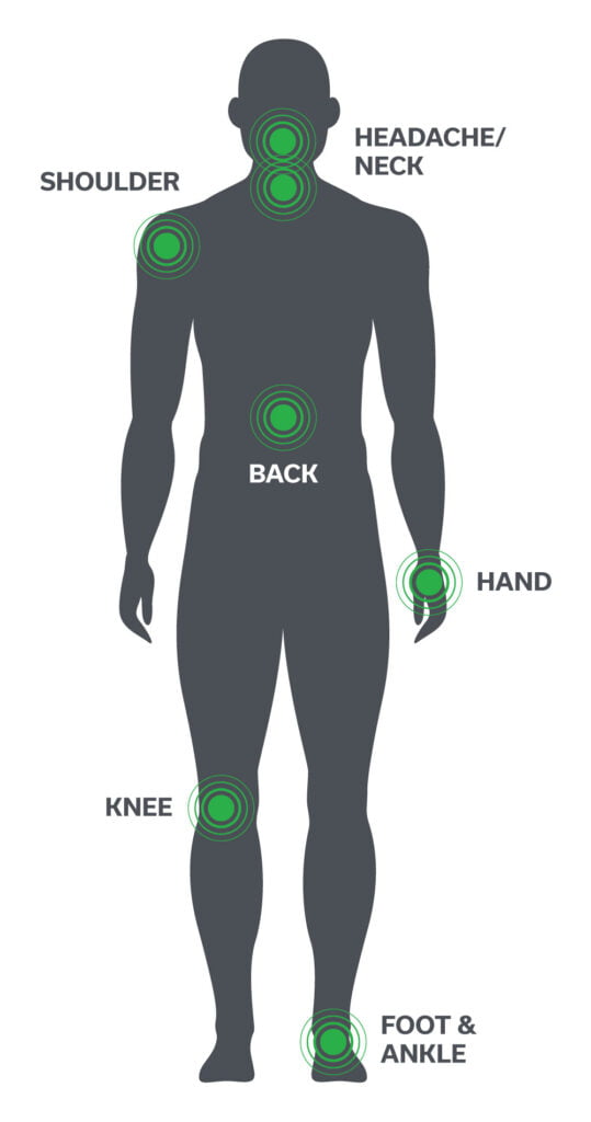 sprint treatment areas