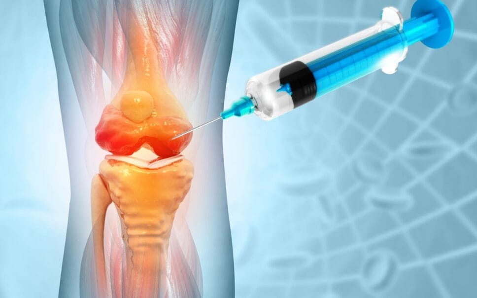 PRP Injection into knee - Alaska Orthopedic Specialists Photo Credit